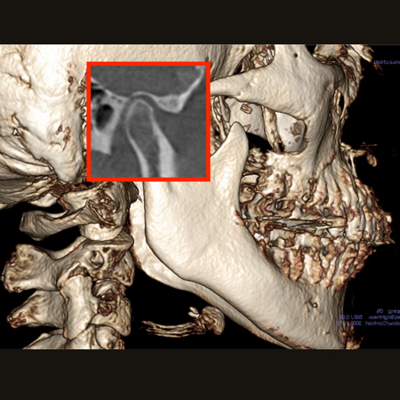 下顎の位置の検査
